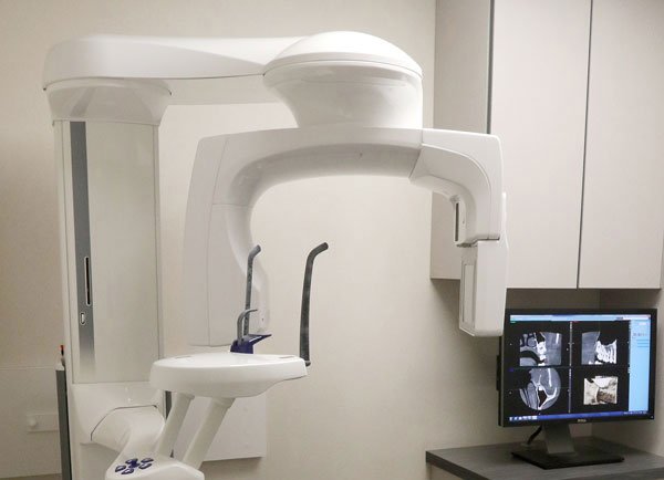 Dental-X-Ray-Machine